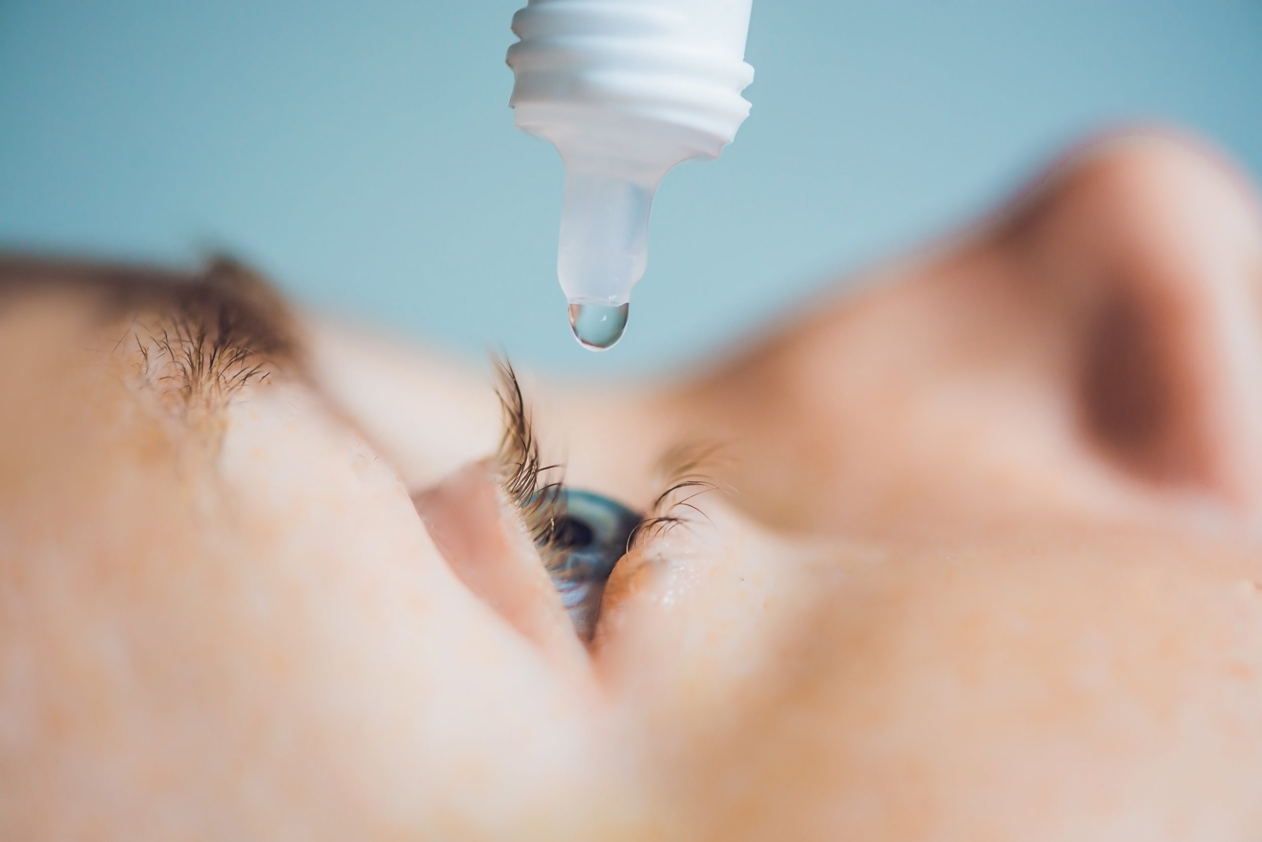 Allergies and Dry Eyes: What’s the Difference?